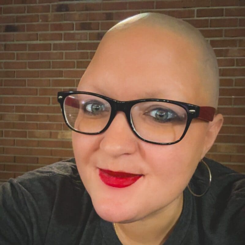 Samantha, a young patient from Kentucky, smiles wearing red lipstick.